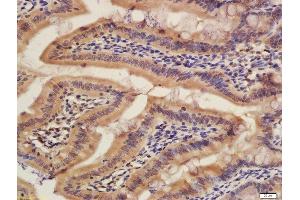Formalin-fixed and paraffin embedded rat colon labeled with Rabbit Rabbit Anti-CISD1 Polyclonal Antibody, Unconjugated (ABIN2173059) at 1:200 followed by conjugation to the secondary antibody and DAB staining (CISD1 antibody  (AA 51-108))