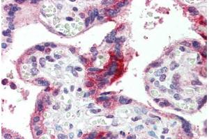 Placenta, Human: Formalin-Fixed, Paraffin-Embedded (FFPE) (GPSM2 antibody  (AA 72-121))