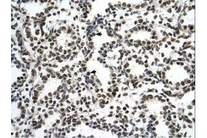 Image no. 1 for anti-Zinc Finger Protein 706 (ZNF706) (N-Term) antibody (ABIN6737704) (ZNF706 antibody  (N-Term))