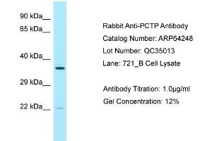 Western Blotting (WB) image for anti-Phosphatidylcholine Transfer Protein (PCTP) (Middle Region) antibody (ABIN2789778) (PCTP antibody  (Middle Region))