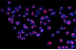 IF analysis of RRS1 using anti-RRS1 antibody (ABIN7601344). (RRS1 antibody  (AA 33-266))