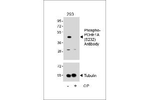 Western blot analysis of lysates from 293 cell line, untreated or treated with CIP, 100 ng/mL, using Phospho-PDHE1A Antibody (upper) or Tubulin (lower). (Pyruvate Dehydrogenase E1 alpha (pSer232) antibody)