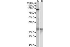 Western Blotting (WB) image for anti-Acetyl LDL Receptor (SCARF1) (AA 20-30) antibody (ABIN293330)