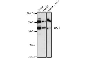 Western blot analysis of extracts of various cell lines, using CPSF7 antibody (ABIN6292490) at 1:3000 dilution. (CPSF7 antibody)