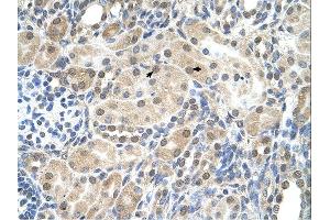 Immunohistochemistry (IHC) image for anti-Solute Carrier Family 9, Subfamily A (NHE9, Cation Proton Antiporter 9), Member 9 (SLC9A9) (C-Term) antibody (ABIN2781738) (SLC9A9 antibody  (C-Term))