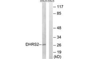 Western Blotting (WB) image for anti-Dehydrogenase/reductase (SDR Family) Member 2 (DHRS2) (AA 111-160) antibody (ABIN2890256) (DHRS2 antibody  (AA 111-160))