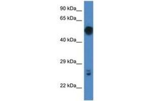 Image no. 1 for anti-Galactose 3-O-Sulfotransferase 4 (GAL3ST4) (C-Term) antibody (ABIN6747383) (GAL3ST4 antibody  (C-Term))