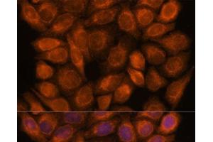 Immunofluorescence analysis of HeLa cells using SNX15 Polyclonal Antibody at dilution of 1:100. (SNX15 antibody)