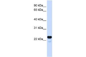 WB Suggested Anti-C1QTNF1 Antibody Titration:  0. (C1QTNF1 antibody  (N-Term))