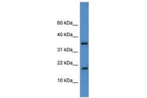Image no. 1 for anti-WW Domain Binding Protein 5 (WBP5) (AA 44-93) antibody (ABIN6746164) (WW Domain Binding Protein 5 (WBP5) (AA 44-93) antibody)