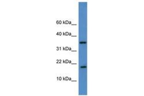 WW Domain Binding Protein 5 (WBP5) (AA 44-93) antibody