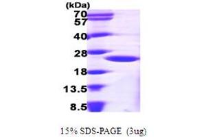 SDS-PAGE (SDS) image for ADP-Ribosylation Factor 1 (ARF1) (AA 1-181) protein (His tag) (ABIN667162)