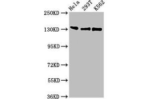 Western Blot Positive WB detected in: Hela whole cell lysate, 293T whole cell lysate, K562 whole cell lysate All lanes: RFX1 antibody at 3 μg/mL Secondary Goat polyclonal to rabbit IgG at 1/50000 dilution Predicted band size: 105 kDa Observed band size: 105 kDa