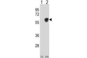 Western Blotting (WB) image for anti-Nucleosome Assembly Protein 1-Like 1 (NAP1L1) antibody (ABIN3000775)