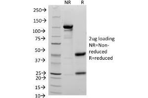 SDS-PAGE Analysis Purified CD48 Mouse Monoclonal Antibody (156-4H9). (CD48 antibody)