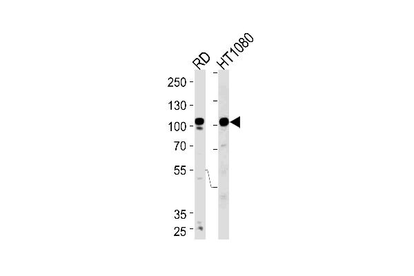 ATP2A1/SERCA1 antibody  (C-Term)