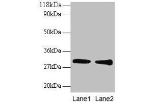 Western blot All lanes: GSTP1 antibody at 2 μg/mL Lane 1: EC109 whole cell lysate Lane 2: 293T whole cell lysate Secondary Goat polyclonal to rabbit IgG at 1/15000 dilution Predicted band size: 24 kDa Observed band size: 30 kDa (GSTP1 antibody  (AA 2-210))
