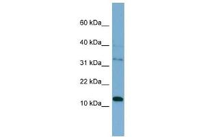 PHLDA2 antibody used at 1 ug/ml to detect target protein. (PHLDA2 antibody  (Middle Region))