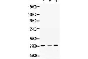 Western blot analysis of SRI expression in rat liver extract ( Lane 1), rat brain extract ( Lane 2) and SMMC7721 whole cell lysates ( Lane 3).