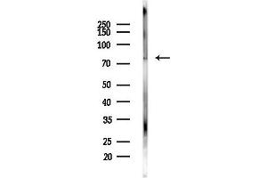 anti-Ring Finger Protein 169 (RNF169) antibody