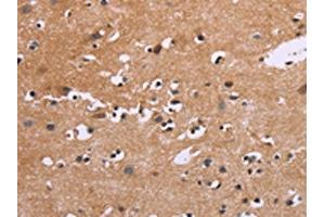 The image on the left is immunohistochemistry of paraffin-embedded Human brain tissue using ABIN7190535(EGR4 Antibody) at dilution 1/20, on the right is treated with synthetic peptide. (EGR4 antibody)