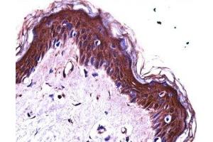 S100A7 antibody immunohistochemistry analysis in formalin fixed and paraffin embedded human skin tissue. (S100A7 antibody  (AA 2-31))
