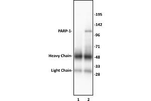 PARP-1 N-terminal antibody (pAb) tested by Immunoprecipitation. (PARP1 antibody  (N-Term))