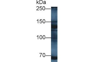 Detection of MYT1 in Mouse Liver lysate using Polyclonal Antibody to Myelin Transcription Factor 1 (MYT1) (MYT1 antibody  (AA 905-1127))