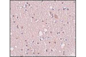Immunohistochemistry of SIPA1L2 in human brain tissue with this product at 5 μg/ml. (SIPA1L2 antibody  (N-Term))
