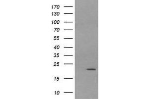 Image no. 7 for anti-Leucine Zipper and CTNNBIP1 Domain Containing (LZIC) antibody (ABIN1499239) (LZIC antibody)