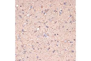 Immunohistochemistry of paraffin-embedded rat brain using GABA transaminase (GABA transaminase (ABAT)) Rabbit mAb (ABIN7265336) at dilution of 1:100 (40x lens). (ABAT antibody)