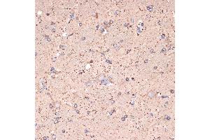 Immunohistochemistry of paraffin-embedded rat brain using GABA transaminase (GABA transaminase (ABAT)) Rabbit mAb (ABIN7265336) at dilution of 1:100 (40x lens). (ABAT antibody)