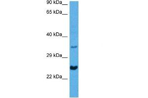 Host:  Mouse  Target Name:  NKX2-5  Sample Tissue:  Mouse Heart  Antibody Dilution:  1ug/ml (NK2 Homeobox 5 antibody  (N-Term))
