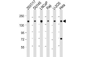 All lanes : Anti-PDS5B Antibody (C-Term) at 1:2000 dilution Lane 1: 293T/17 whole cell lysate Lane 2: D whole cell lysate Lane 3: LNCaP whole cell lysate Lane 4: Raji whole cell lysate Lane 5: U-2OS whole cell lysate Lane 6: Hela whole cell lysate Lysates/proteins at 20 μg per lane. (PDS5B antibody  (AA 1197-1228))