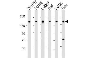 PDS5B anticorps  (AA 1197-1228)