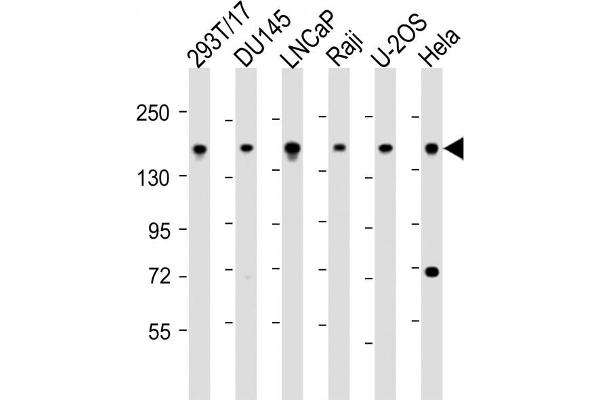 PDS5B anticorps  (AA 1197-1228)