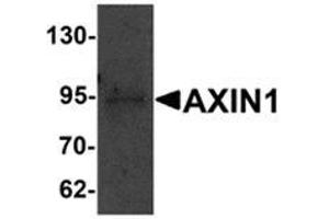 Western blot analysis of AXIN1 in SK-N-SH cell lysate with AXIN1 antibody at 1 μg/ml.
