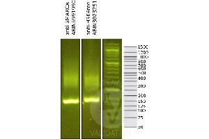 Library profiles comparing fragment size distributions on an E-Gel EX 2% agarose gel (Thermo Fisher). (SMARCA4 antibody  (C-Term))