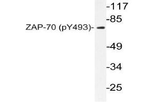 Western blot (WB) analyzes of p-ZAP-70 in extracts from Jurkat cells.