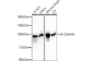 Western blot analysis of extracts of various cell lines, using β-Catenin Mouse mAb antibody (ABIN7266137) at 1:1000 dilution. (CTNNB1 antibody)