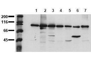 Western Blotting (WB) image for anti-Catenin (Cadherin-Associated Protein), beta 1, 88kDa (CTNNB1) (C-Term) antibody (ABIN126749) (CTNNB1 antibody  (C-Term))