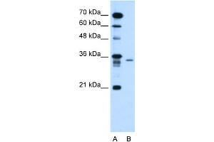 WB Suggested Anti-C6orf21 Antibody Titration:  1.