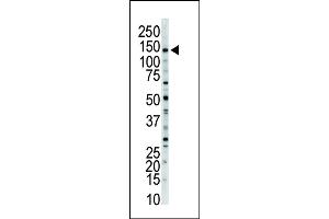 Western blot analysis of anti-MLCK-long Pab (ABIN392495 and ABIN2842065) in mouse brain tissue lysate. (MYLK antibody  (N-Term))