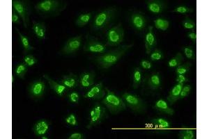 Image no. 2 for anti-Adrenocortical Dysplasia Homolog (ACD) (AA 1-545) antibody (ABIN599297) (ACD antibody  (AA 1-545))