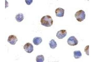 Immunohistochemistry (IHC) image for anti-NLR Family, Pyrin Domain Containing 1 (NLRP1) (C-Term) antibody (ABIN1030530)