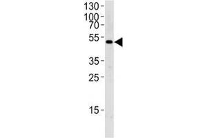 Western blot analysis of lysate from MCF-7 cell line using SOCS4 antibody diluted at 1:1000 for each lane.