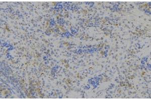 ABIN6279516 at 1/100 staining Human lymph node tissue by IHC-P.