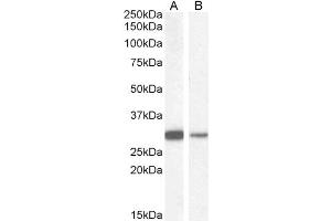 Western Blotting (WB) image for anti-NAD(P)H Dehydrogenase, Quinone 1 (NQO1) (C-Term) antibody (ABIN184714)