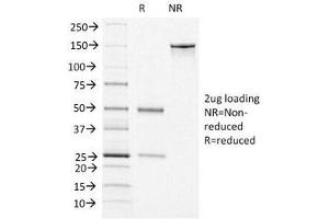 SDS-PAGE Analysis of Purified, BSA-Free vWF Antibody (clone VWF/1465). (VWF antibody  (AA 1815-1939))