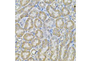 Immunohistochemistry of paraffin-embedded mouse kidney using AP2A1 Antibody (ABIN5975765) at dilution of 1/100 (40x lens). (alpha Adaptin antibody)